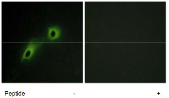 Immunocytochemistry/ Immunofluorescence - Anti-CAMKV antibody (AB69564), expandable thumbnail