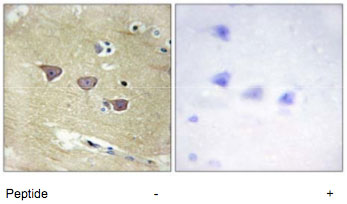 Immunohistochemistry (Formalin/PFA-fixed paraffin-embedded sections) - Anti-CAMKV antibody (AB69564), expandable thumbnail