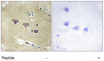 Immunohistochemistry (Formalin/PFA-fixed paraffin-embedded sections) - Anti-CAMKV antibody (AB69564)