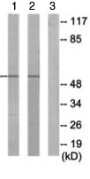 Western blot - Anti-CAMKV antibody (AB69564), expandable thumbnail