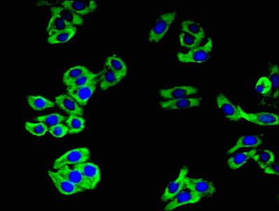 Immunocytochemistry/ Immunofluorescence - Anti-CAMLG/CAML antibody (AB236655)
