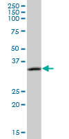 Western blot - Anti-CAMLG/CAML antibody (AB67714)