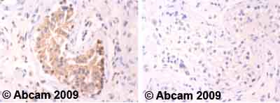 Immunohistochemistry (Formalin/PFA-fixed paraffin-embedded sections) - Anti-cAMP Protein Kinase Catalytic subunit antibody (AB26322), expandable thumbnail