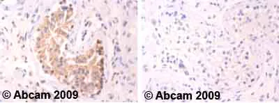 Immunohistochemistry (Formalin/PFA-fixed paraffin-embedded sections) - Anti-cAMP Protein Kinase Catalytic subunit antibody (AB26322)