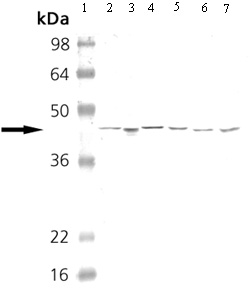 Western blot - Anti-cAMP Protein Kinase Catalytic subunit antibody (AB26322), expandable thumbnail