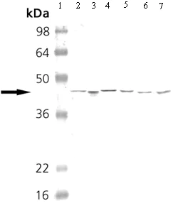 Western blot - Anti-cAMP Protein Kinase Catalytic subunit antibody (AB26322)