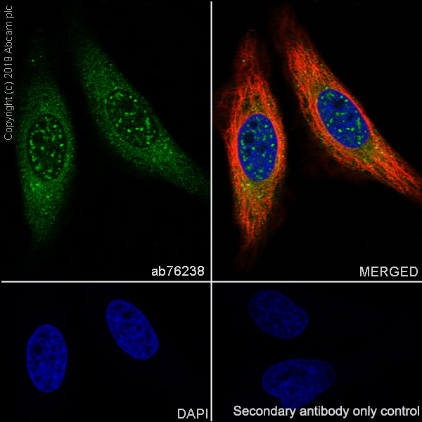 Immunocytochemistry/ Immunofluorescence - Anti-cAMP Protein Kinase Catalytic subunit antibody [EP2102Y] (AB76238), expandable thumbnail