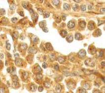 Immunohistochemistry (Formalin/PFA-fixed paraffin-embedded sections) - Anti-cAMP Protein Kinase Catalytic subunit antibody [EP2102Y] (ab76238), expandable thumbnail