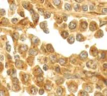 Immunohistochemistry (Formalin/PFA-fixed paraffin-embedded sections) - Anti-cAMP Protein Kinase Catalytic subunit antibody [EP2102Y] (AB76238)