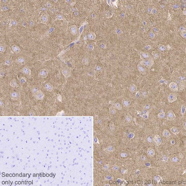 Immunohistochemistry (Formalin/PFA-fixed paraffin-embedded sections) - Anti-cAMP Protein Kinase Catalytic subunit antibody [EP2102Y] (ab76238), expandable thumbnail