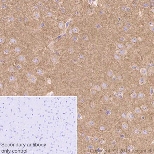 Immunohistochemistry (Formalin/PFA-fixed paraffin-embedded sections) - Anti-cAMP Protein Kinase Catalytic subunit antibody [EP2102Y] (AB76238)