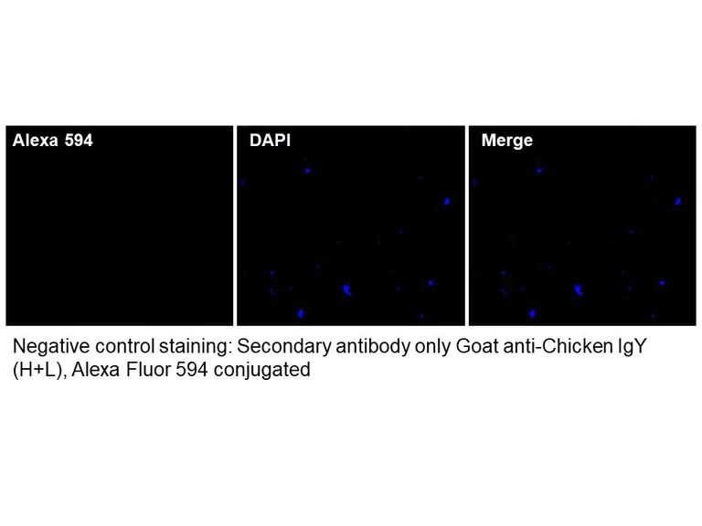 Immunocytochemistry/ Immunofluorescence - Anti-Campylobacter Jejuni antibody (AB325763)