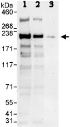 Western blot - Anti-CAMSAP1 antibody (AB86001)