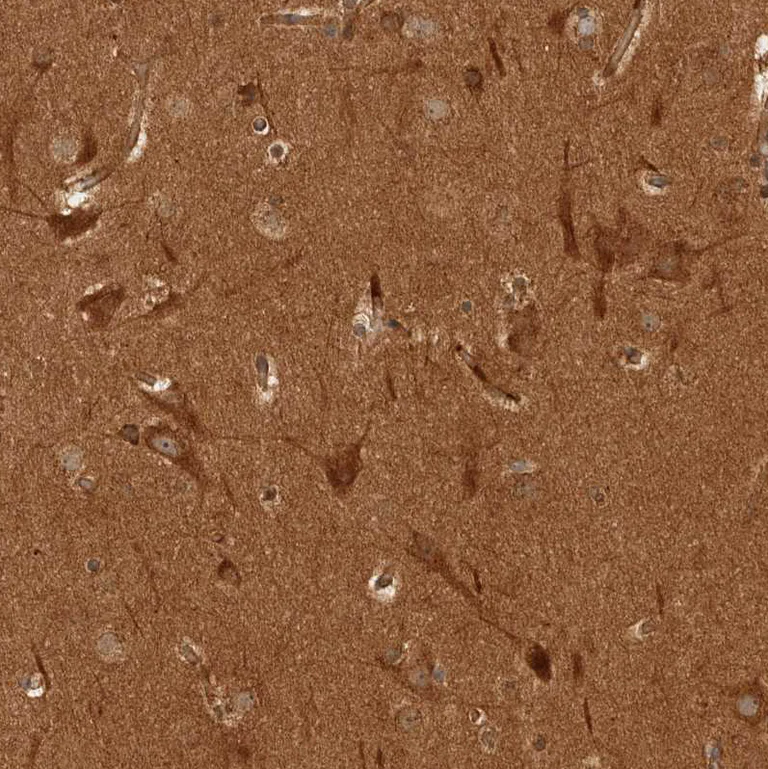Immunohistochemistry (Formalin/PFA-fixed paraffin-embedded sections) - Anti-CAMSAP2 antibody (AB251766)