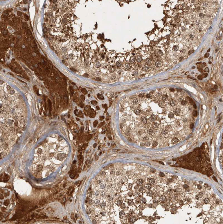 Immunohistochemistry (Formalin/PFA-fixed paraffin-embedded sections) - Anti-CAMSAP2 antibody (AB251766)
