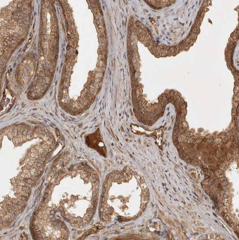 Immunohistochemistry (Formalin/PFA-fixed paraffin-embedded sections) - Anti-CAMSAP2 antibody (AB251766)