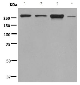 Western blot - Anti-CAMSAP2 antibody [EPR7718(B)] (AB140619), expandable thumbnail