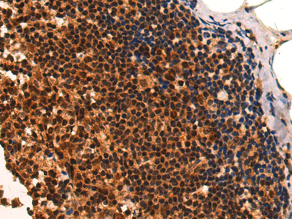 Immunohistochemistry (Formalin/PFA-fixed paraffin-embedded sections) - Anti-CAMTA1 antibody (AB199116)