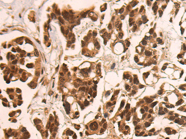 Immunohistochemistry (Formalin/PFA-fixed paraffin-embedded sections) - Anti-CAMTA1 antibody (AB199116)