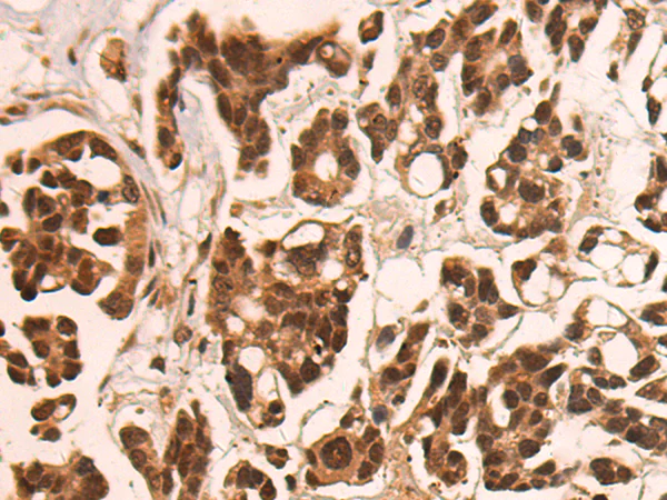 Immunohistochemistry (Formalin/PFA-fixed paraffin-embedded sections) - Anti-CAMTA1 antibody (AB199116)