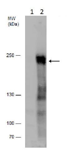 Western blot - Anti-CAMTA1 antibody (AB227713)