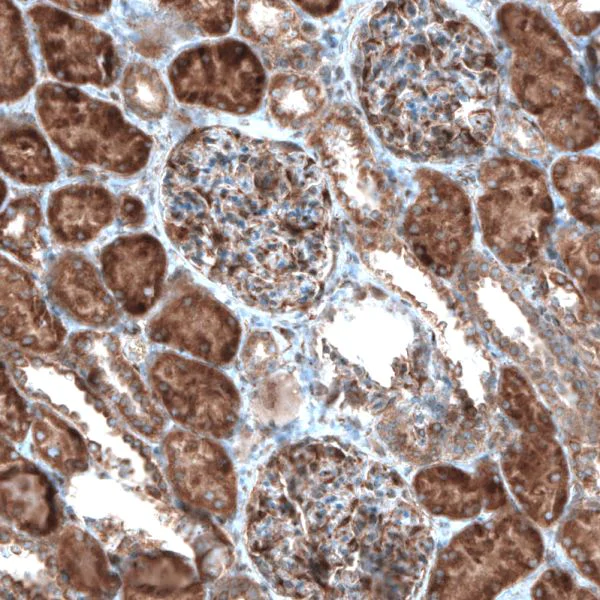 Immunohistochemistry (Formalin/PFA-fixed paraffin-embedded sections) - Anti-CAMTA1 antibody (AB251843)