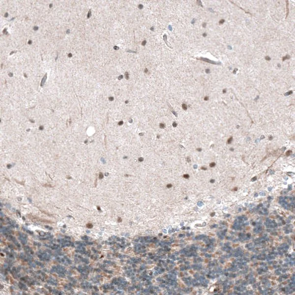 Immunohistochemistry (Formalin/PFA-fixed paraffin-embedded sections) - Anti-CAMTA1 antibody (AB251843)