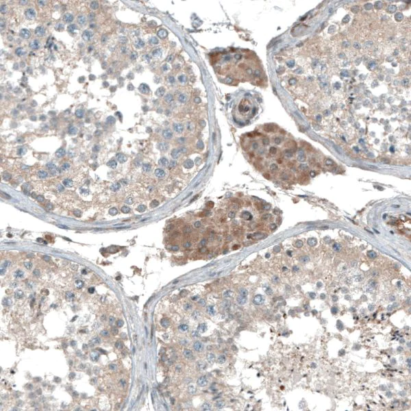 Immunohistochemistry (Formalin/PFA-fixed paraffin-embedded sections) - Anti-CAMTA1 antibody (AB251843)