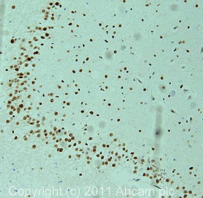 Immunohistochemistry (Formalin/PFA-fixed paraffin-embedded sections) - Anti-CAMTA1 antibody (AB64119)