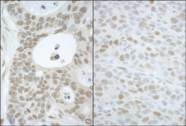 Immunohistochemistry (Formalin/PFA-fixed paraffin-embedded sections) - Anti-CAND1 antibody (AB101987)