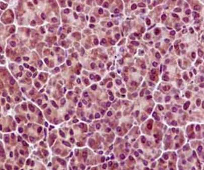 Immunohistochemistry (Formalin/PFA-fixed paraffin-embedded sections) - Anti-CAND1 antibody [EPR14241] - BSA and Azide free (AB250708)