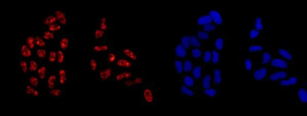 Immunocytochemistry/ Immunofluorescence - Anti-CAND1 antibody [EPR14242(B)] - C-terminal (AB181216)