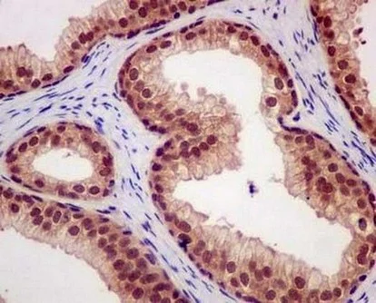 Immunohistochemistry (Formalin/PFA-fixed paraffin-embedded sections) - Anti-CAND1 antibody [EPR14242(B)] - C-terminal (AB181216)
