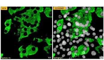 Immunocytochemistry/ Immunofluorescence - Anti-Canine Coronavirus antibody [6B8] (AB325982)