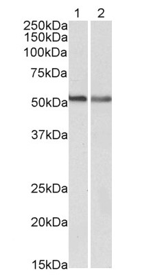 Western blot - Anti-Cannabinoid Receptor I antibody (AB118277)
