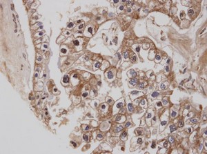 Immunohistochemistry (Formalin/PFA-fixed paraffin-embedded sections) - Anti-Cannabinoid Receptor I antibody (AB137410), expandable thumbnail