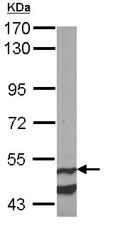 Western blot - Anti-Cannabinoid Receptor I antibody (AB137410), expandable thumbnail