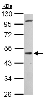 Western blot - Anti-Cannabinoid Receptor I antibody (AB137410), expandable thumbnail