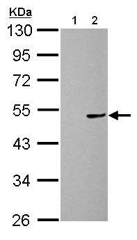 Western blot - Anti-Cannabinoid Receptor I antibody (AB137410), expandable thumbnail