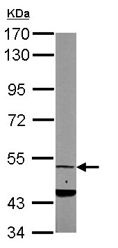 Western blot - Anti-Cannabinoid Receptor I antibody (AB137410), expandable thumbnail