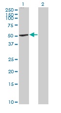 Western blot - Anti-Cannabinoid Receptor I antibody (AB167366), expandable thumbnail