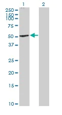 Western blot - Anti-Cannabinoid Receptor I antibody (AB167366)