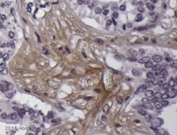 Immunohistochemistry (Formalin/PFA-fixed paraffin-embedded sections) - Anti-Cannabinoid Receptor I antibody (AB23703), expandable thumbnail