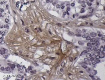 Immunohistochemistry (Formalin/PFA-fixed paraffin-embedded sections) - Anti-Cannabinoid Receptor I antibody (AB23703)