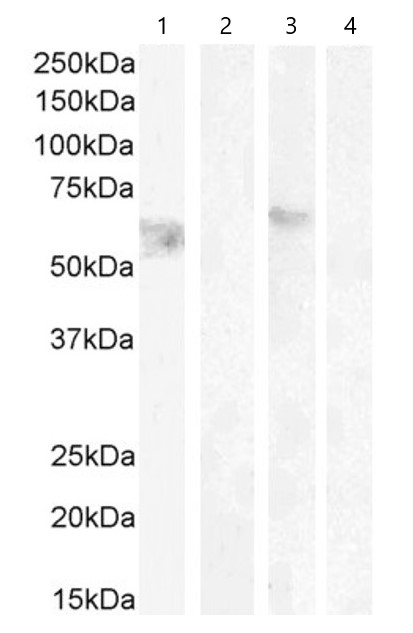 Western blot - Anti-Cannabinoid Receptor I antibody (AB40860), expandable thumbnail