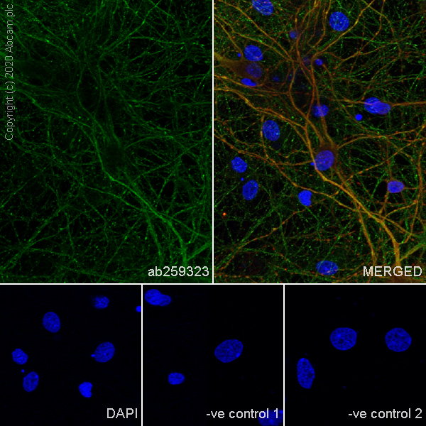 Immunocytochemistry/ Immunofluorescence - Anti-Cannabinoid Receptor I antibody [EPR23934-20] (ab259323), expandable thumbnail