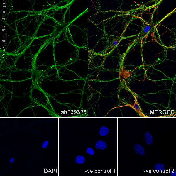 Immunocytochemistry/ Immunofluorescence - Anti-Cannabinoid Receptor I antibody [EPR23934-20] (AB259323), expandable thumbnail