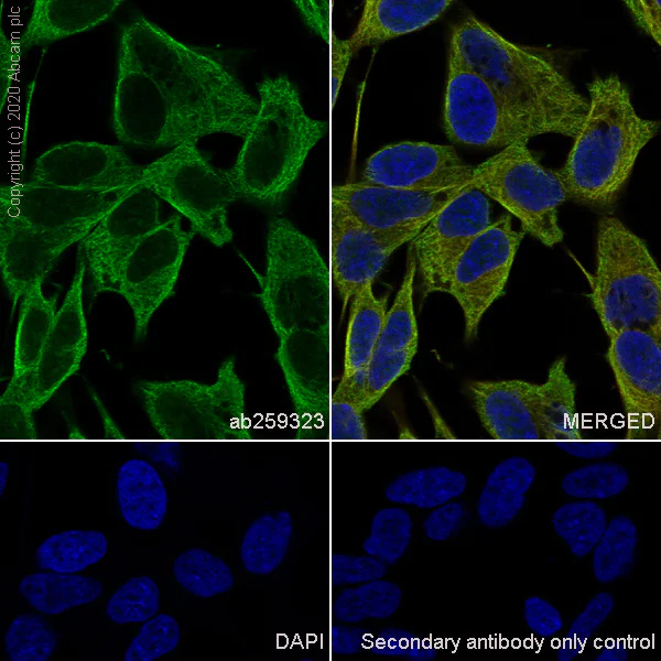 Immunocytochemistry/ Immunofluorescence - Anti-Cannabinoid Receptor I antibody [EPR23934-20] (AB259323)