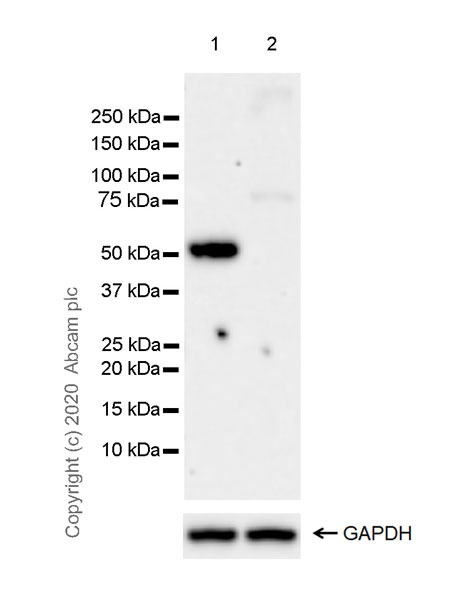 Western blot - Anti-Cannabinoid Receptor I antibody [EPR23934-20] (ab259323), expandable thumbnail
