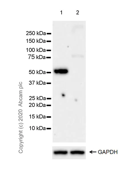 Western blot - Anti-Cannabinoid Receptor I antibody [EPR23934-20] (AB259323)